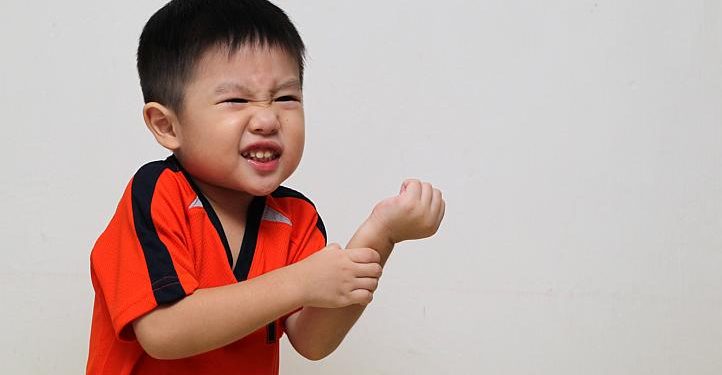 Alergi Makanan pada Anak, Ini Tandanya!