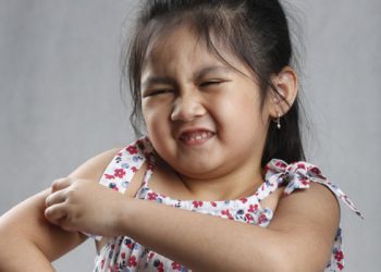 Biduran Pada Anak? Kenali dan Ketahui Cara Mengatasinya!