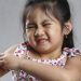 Biduran Pada Anak? Kenali dan Ketahui Cara Mengatasinya!