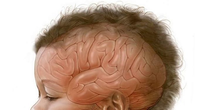 otak anak