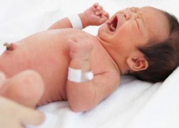 Cara Merawat Tali Pusar Si Kecil Agar Tidak Terkena Infeksi