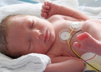 Panduan Dalam Merawat Bayi Prematur
