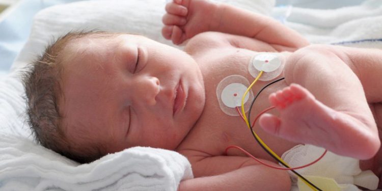 Panduan Dalam Merawat Bayi Prematur