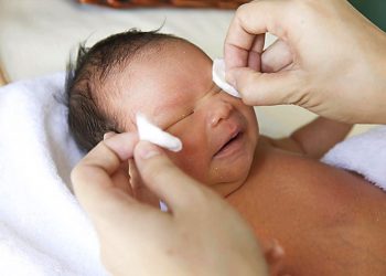Kenapa Terjadi Mata Belekan Pada Bayi dan Cara Mengatasinya