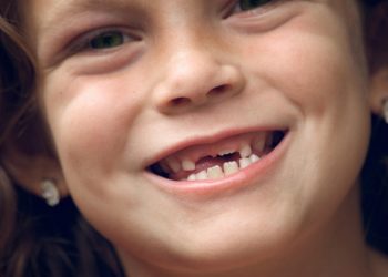 Gigi Tetap Belum Tumbuh, Normalkah?