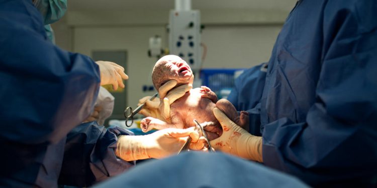 Mau Melahirkan Secara Caesar? Apa saja yang Harus diketahui?