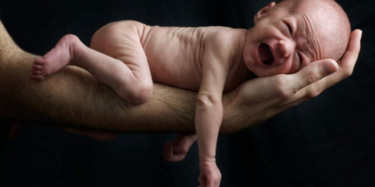 Cari Tahu Penyebab Stunting Anak, Agar Segera Bisa Diatasi!