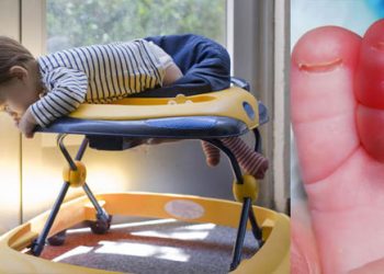 Bahayanya Penggunaan Baby Walker untuk Anak