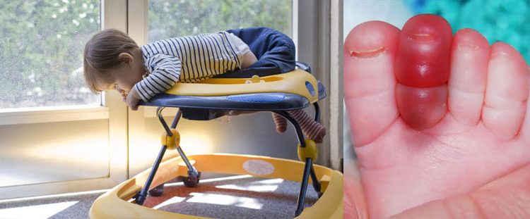 Bahayanya Penggunaan Baby Walker untuk Anak