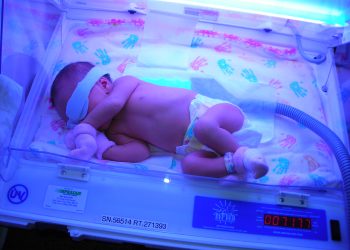 penanganan breast milk jaundice bayi kuning karena asi