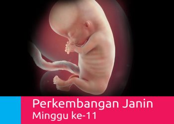 Perkembangan Kehamilan 11 Minggu