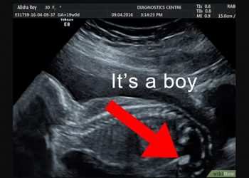 cara membaca hasil usg