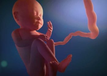 Waspada Plasenta Previa, Ketahui Lebih Dulu Yuk!