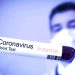 Waspada Mampaps, Ketahui Mengenai Virus Corona Berikut Ini!