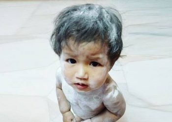 Amankah Si Kecil Menggunakan Bedak Bayi?