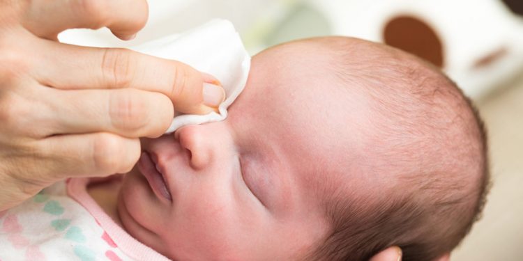 Apa itu Pink Eye pada Bayi? Ketahui Yuk, Mams!