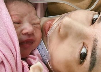 Alice Norin Alami Placenta Previa Totalis Accreta, Ketahui Ma!