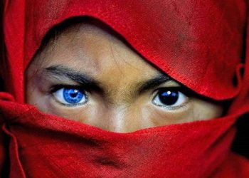 Sindrom Waardenburg, Si Mata Biru dari Sulawesi Tenggara
