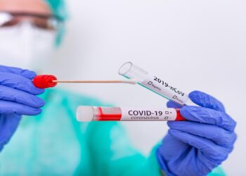 Wajib! Sebelum Liburan Bandara Berlakukan Aturan Rapid Test Antigen