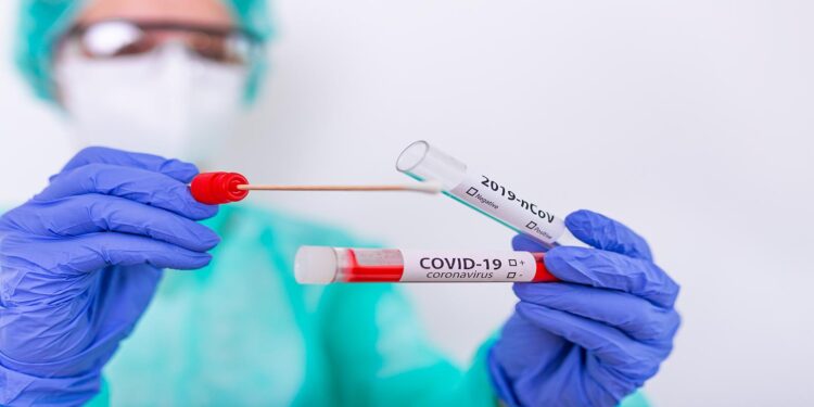 Wajib! Sebelum Liburan Bandara Berlakukan Aturan Rapid Test Antigen