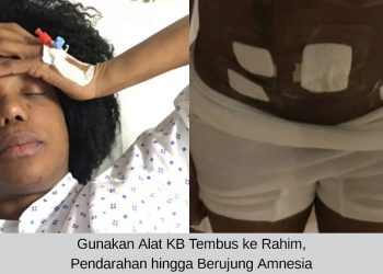 Gunakan Alat Kontrasepsi Tembus ke Rahim Hingga Berujung Amnesia