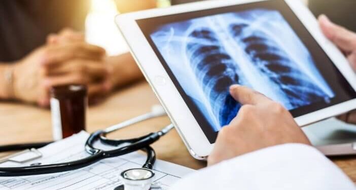 Waspada Penyakit PPOK yang Menyebabkan Kematian