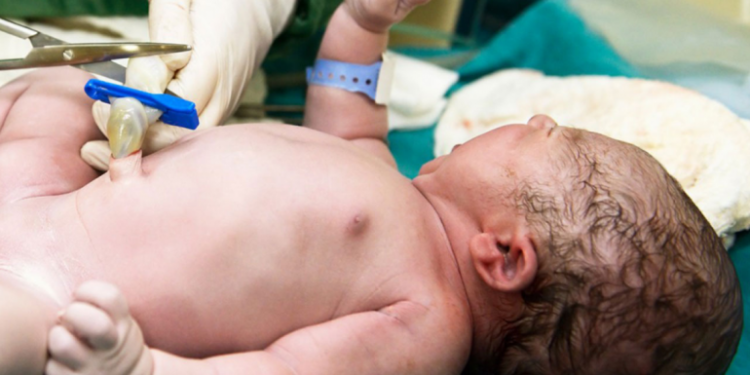 Bank Darah Tali Pusat Sudah Ada di Indonesia Lho, Ma