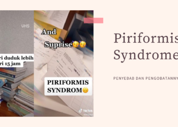 piriformis syndrome