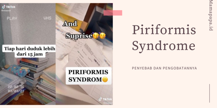 piriformis syndrome
