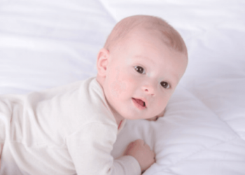 Ketahui Tortikalis pada Bayi Yuk, Mampaps!