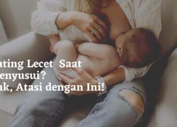 Puting Lecet Saat Menyusui? Yuk, Atasi dengan Ini!