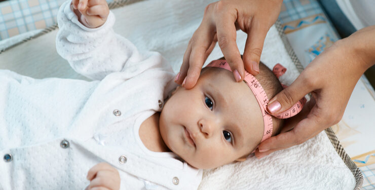Berapa Ukuran Lingkar Kepala Bayi yang Ideal? Ini jawabannya!